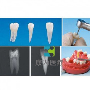 “康為醫(yī)療”帶髓腔根管牙體模型